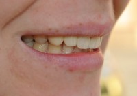 /album/ck-13-23-heraceram/heraceram-3-103-jpg/